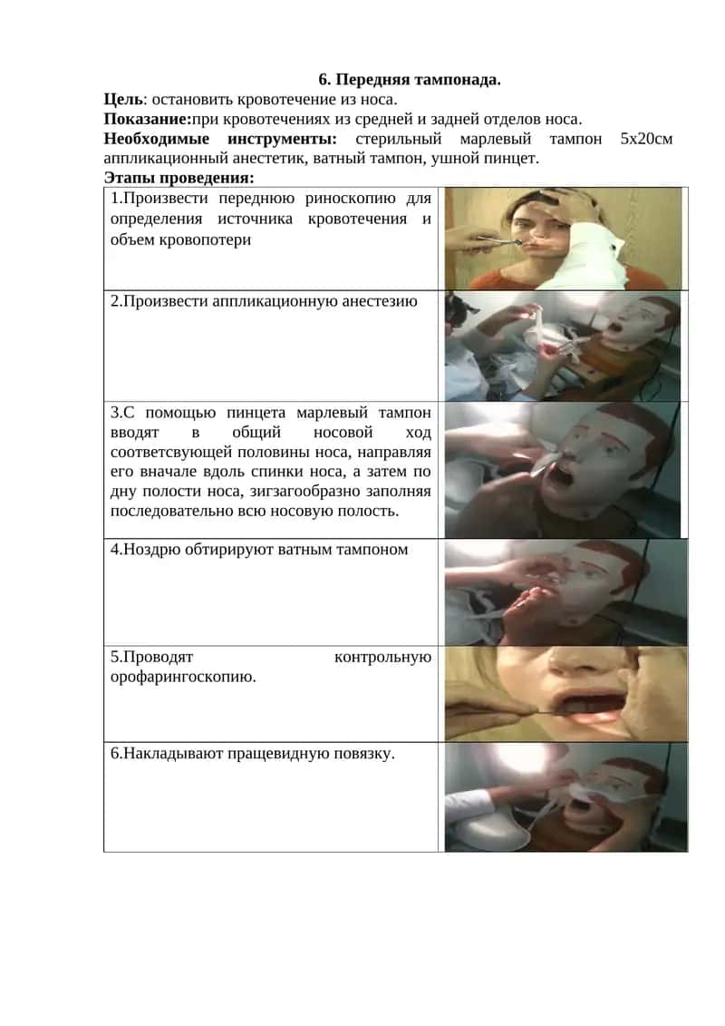 Передняя тампонада 1
