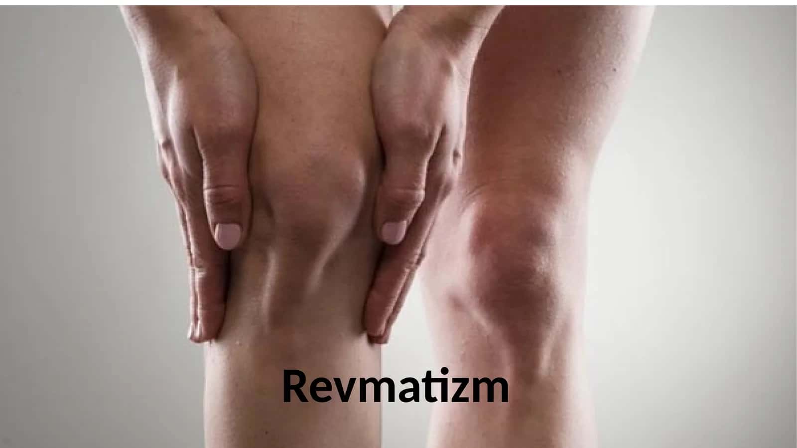 Revmatizm nima. Kasallik haqida umumiy ma’lumot 1