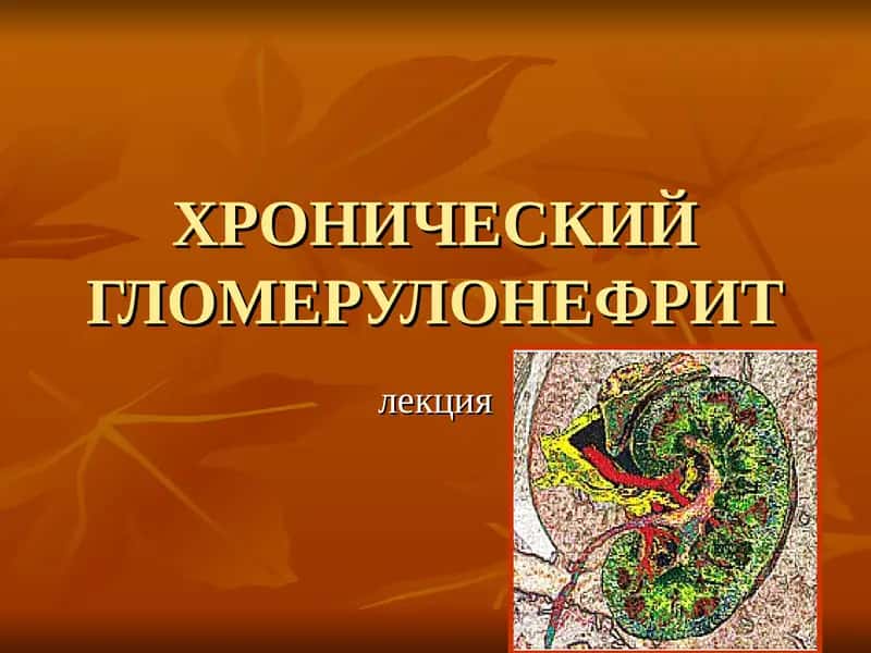 ХРОНИЧЕСКИЙ ГЛОМЕРУЛОНЕФРИТ 1