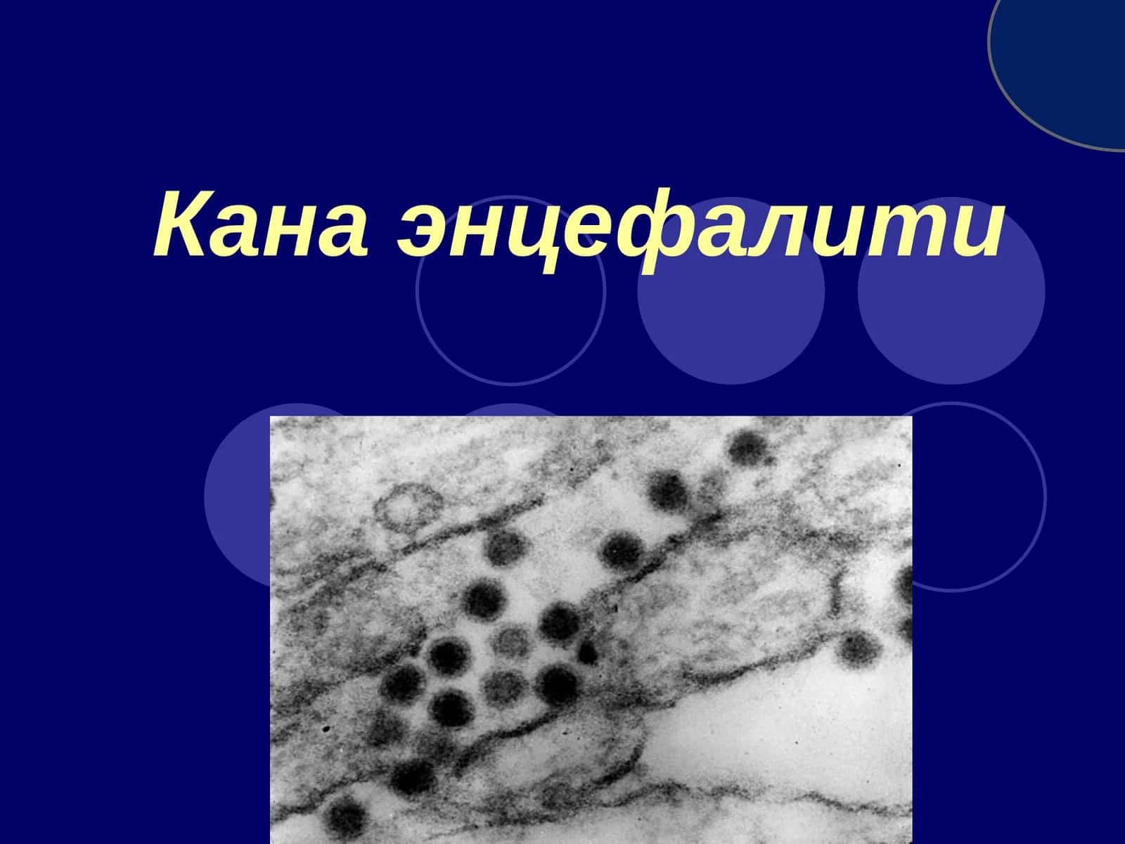 Канаэнцефалити 1
