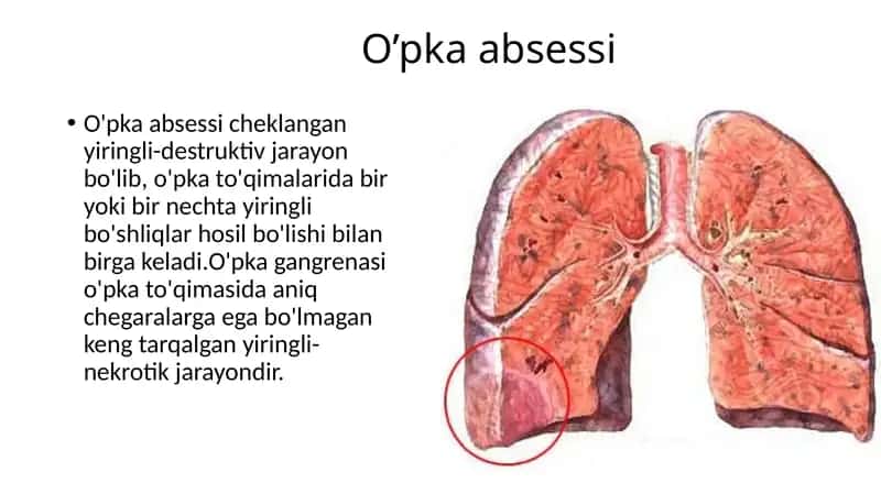 O’pka absessi patogenezi klinikasi va diagnostikasi 1
