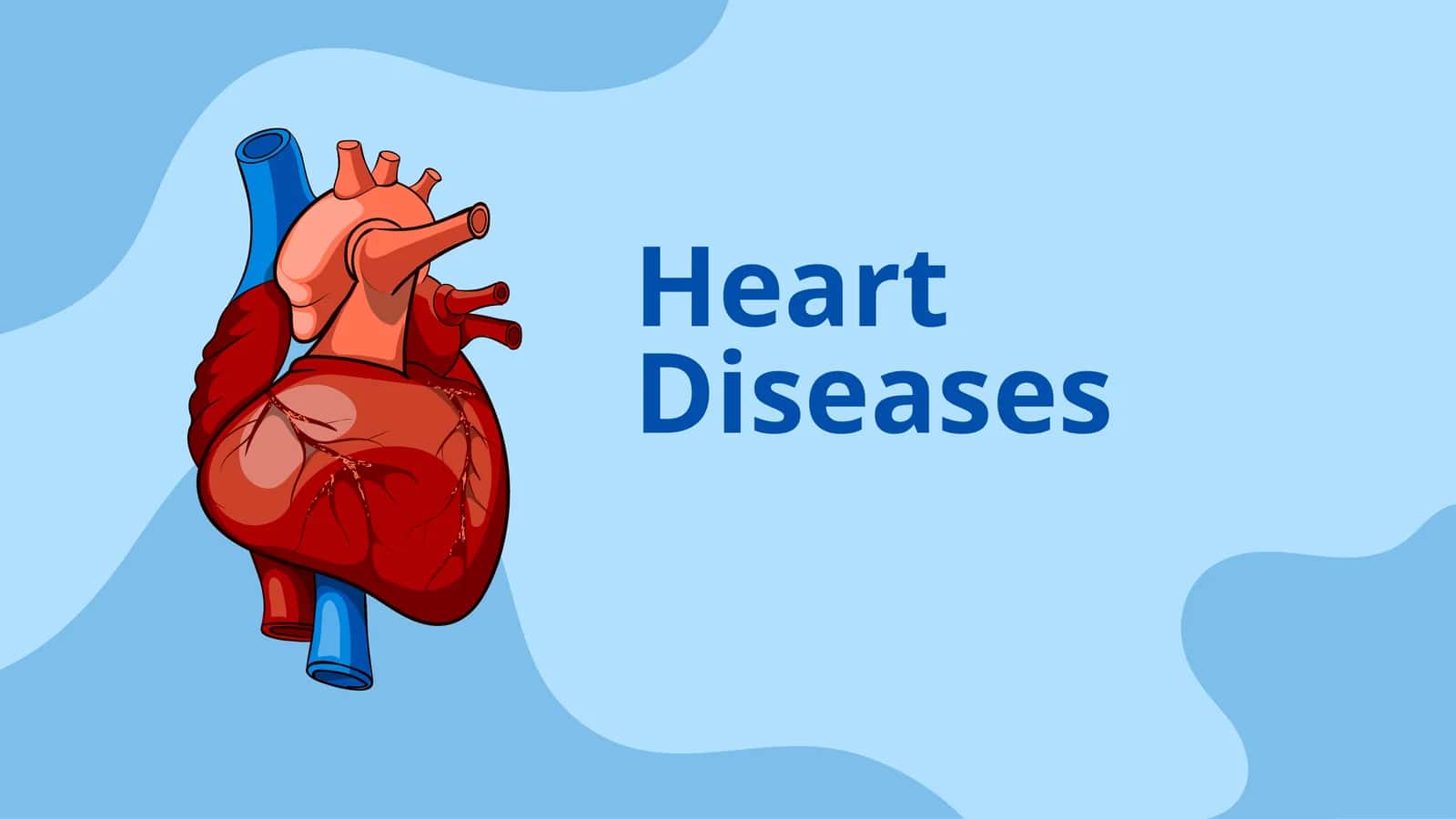 Rheumatic and Infective Heart Diseases 1
