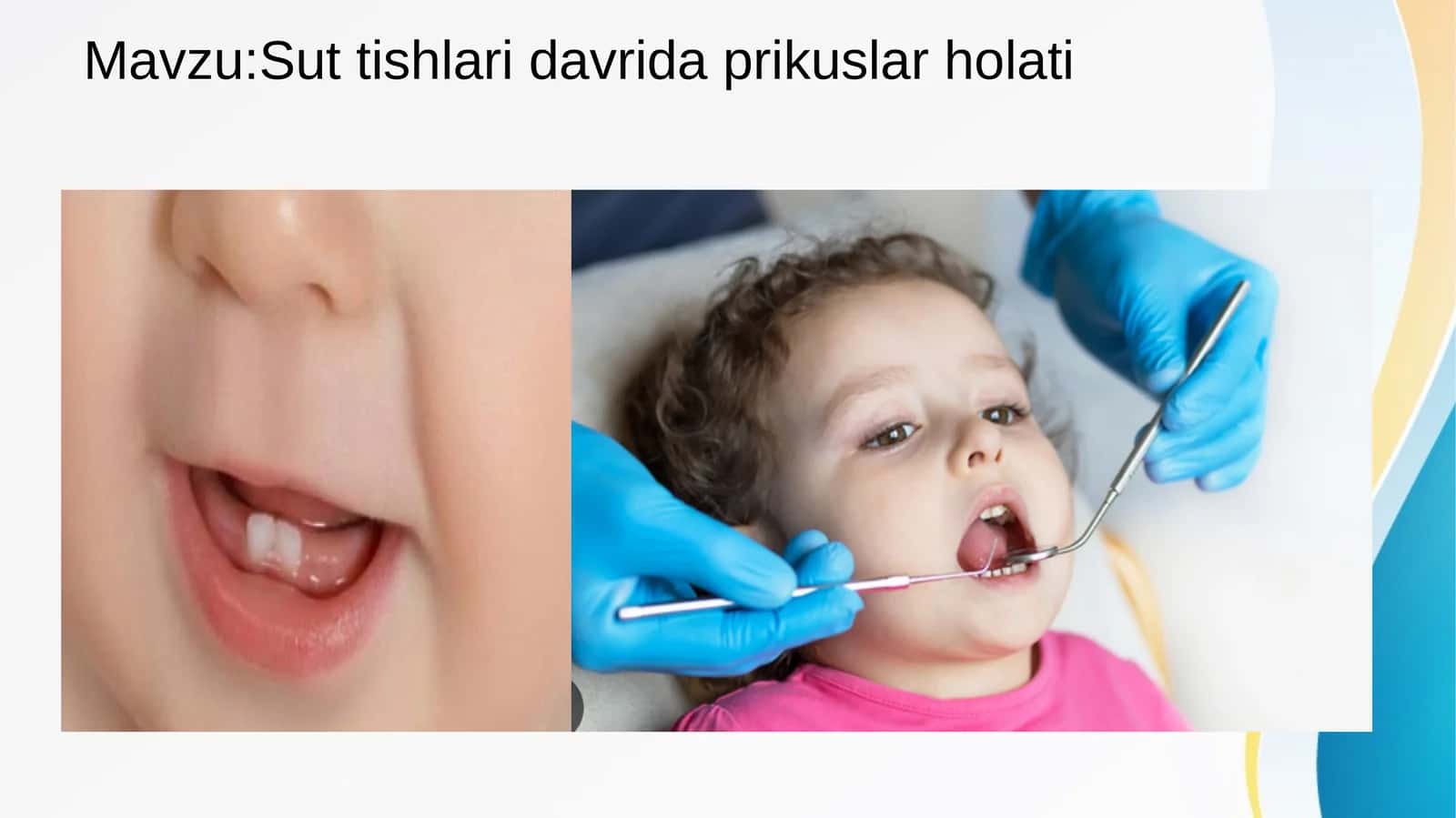 Sut tishlari davrida prikuslar holati 1