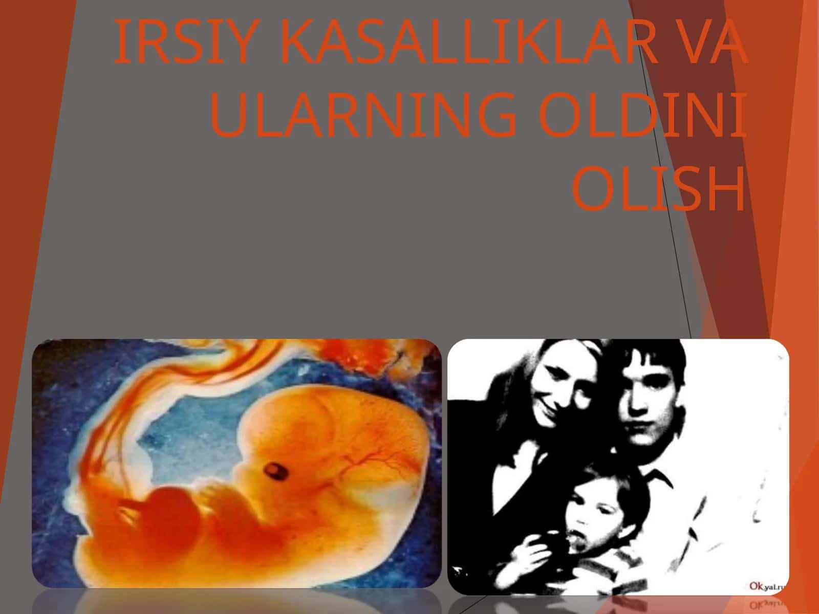 IRSIY KASALLIKLAR VA ULARNING OLDINI OLISH 1