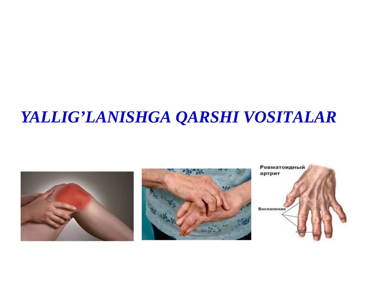 YALLIGʼLАNISHGА QАRSHI VOSITАLАR 1