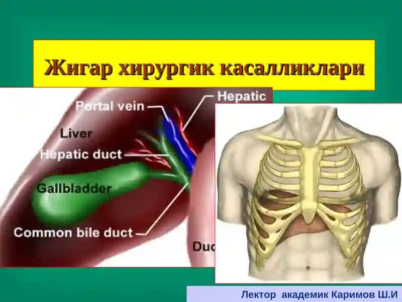 Жигар хирургик касалликлари