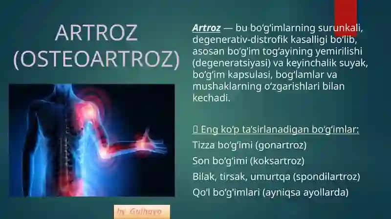 ARTROZ(OSTEOARTROZ)