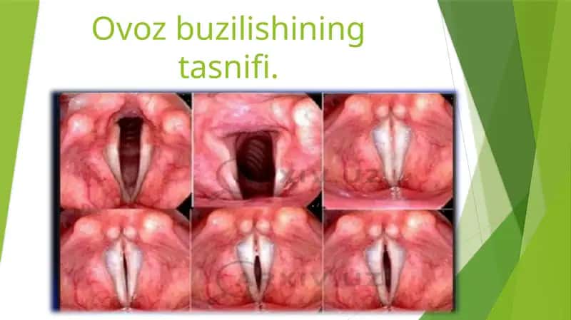 Ovozbuzilishining tasnifi 1
