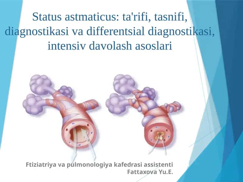 Status astmaticus: ta'rifi, tasnifi, diagnostikasi va differentsial diagnostikasi, intensiv davolash asoslari 1