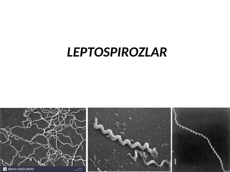 LEPTOSPIROZLAR 1