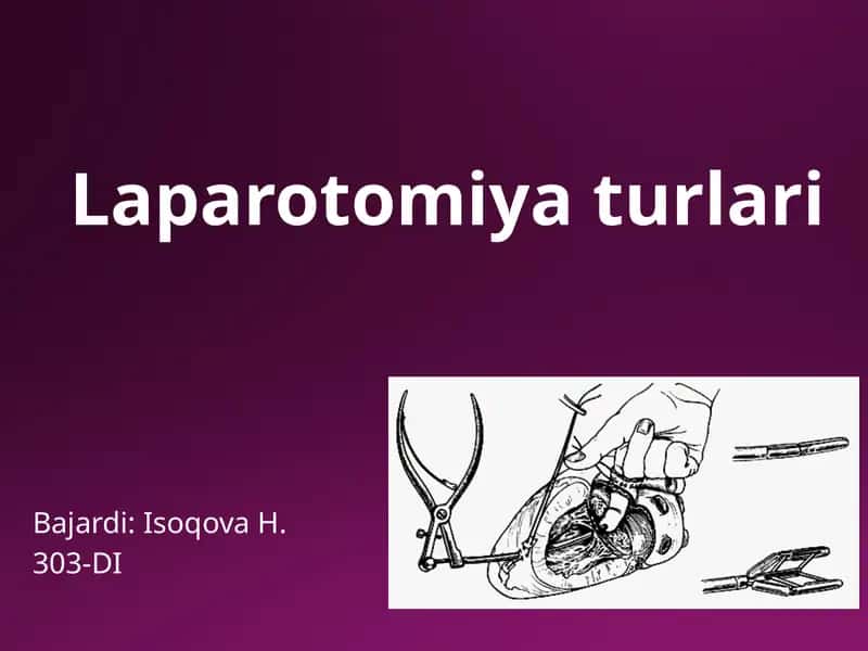 Laparotomiyaturlari 1