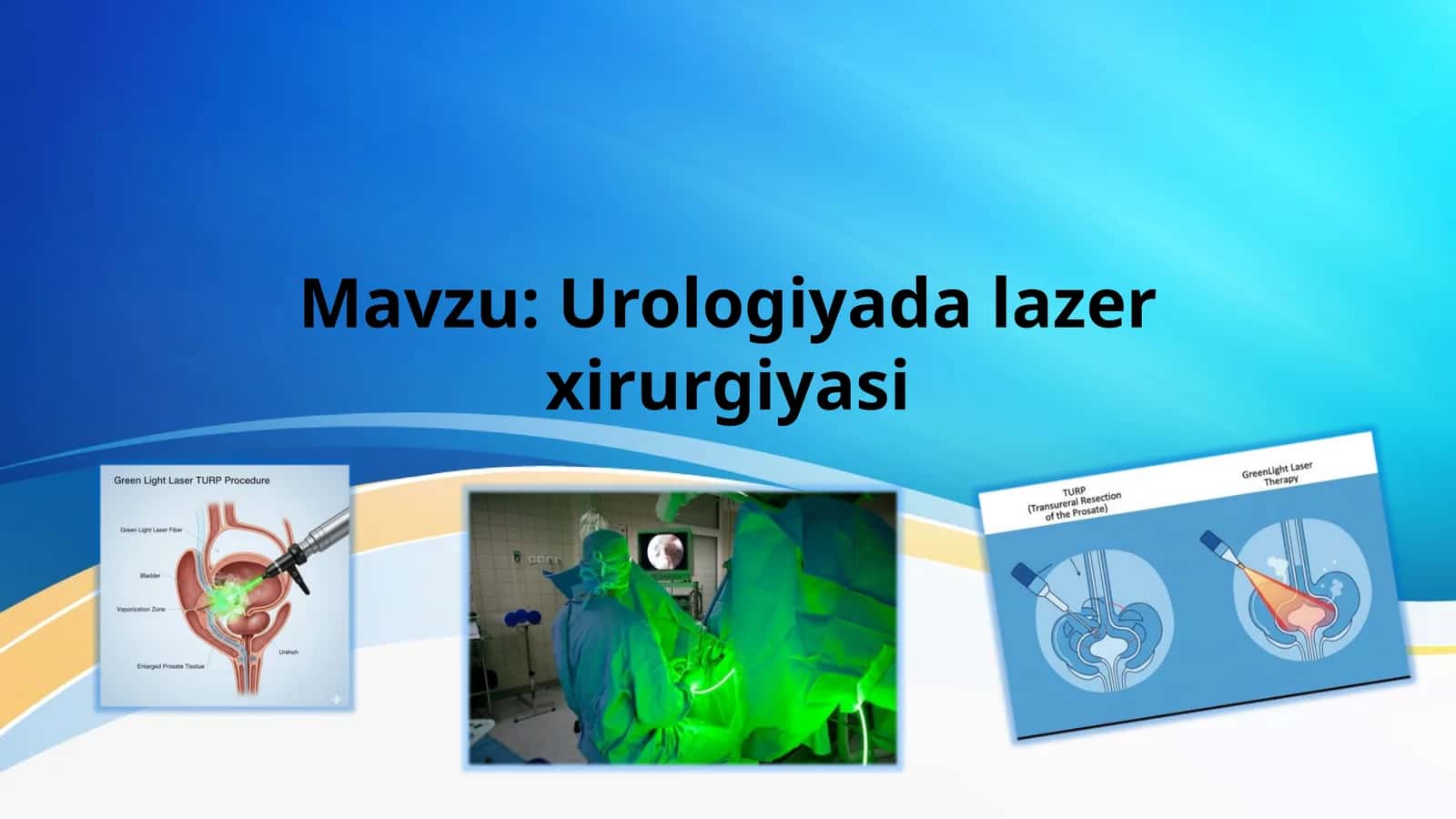Urologiyada lazer xirurgiyasi 1