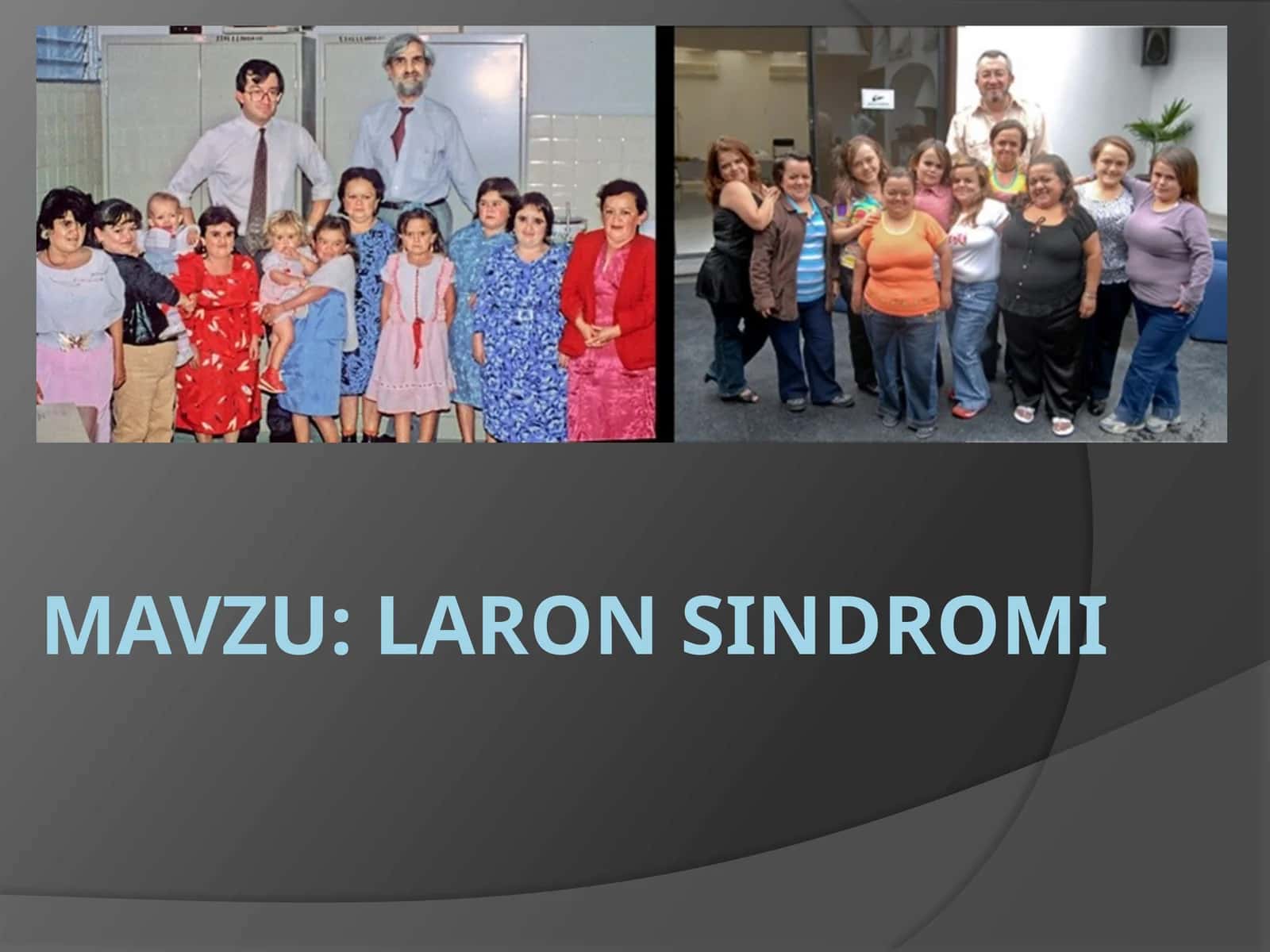 Laron Sindromi 1