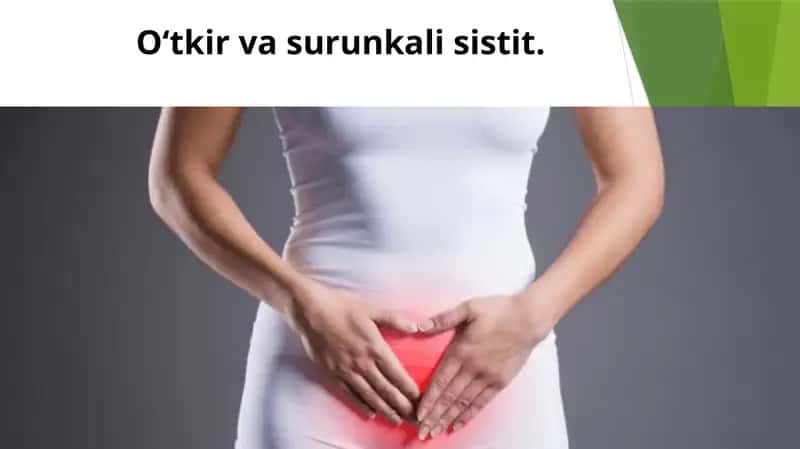 SISTIT-Siydik 1