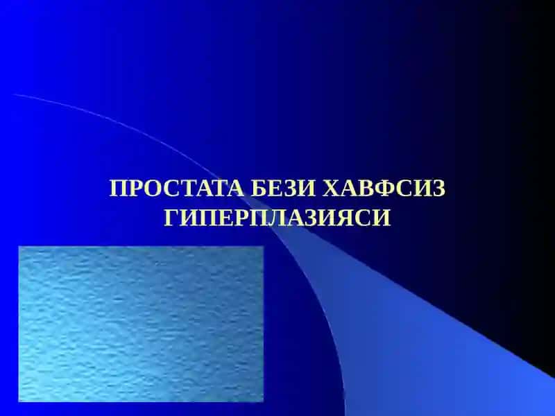 Простата бези хавфсиз гиперплазияси