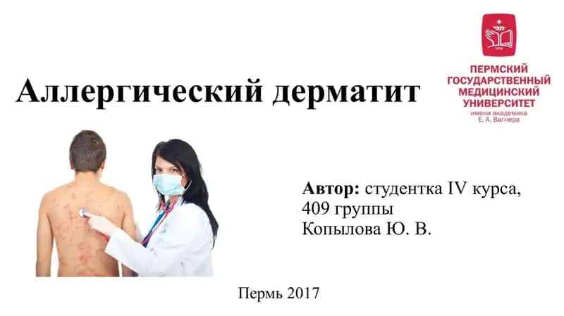 Аллергический дерматит 1