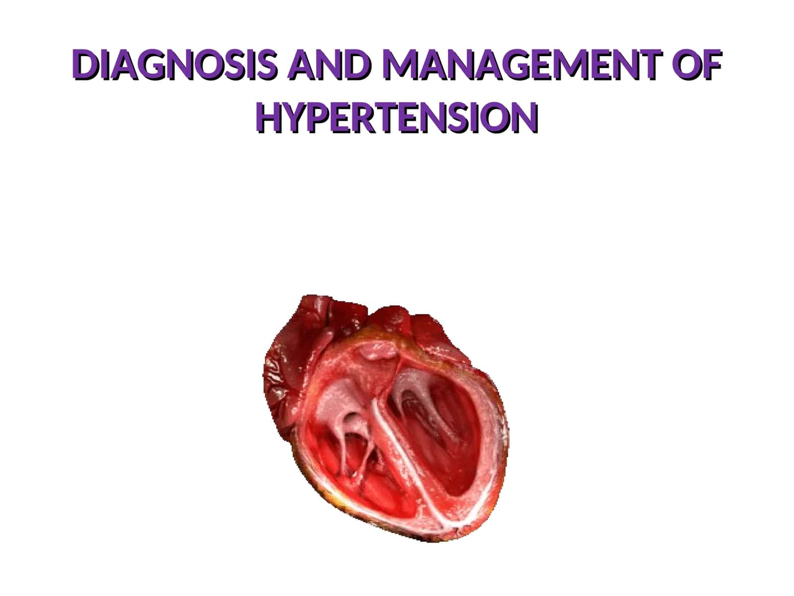 DIAGNOSIS AND MANAGEMENT OF HYPERTENSION 1