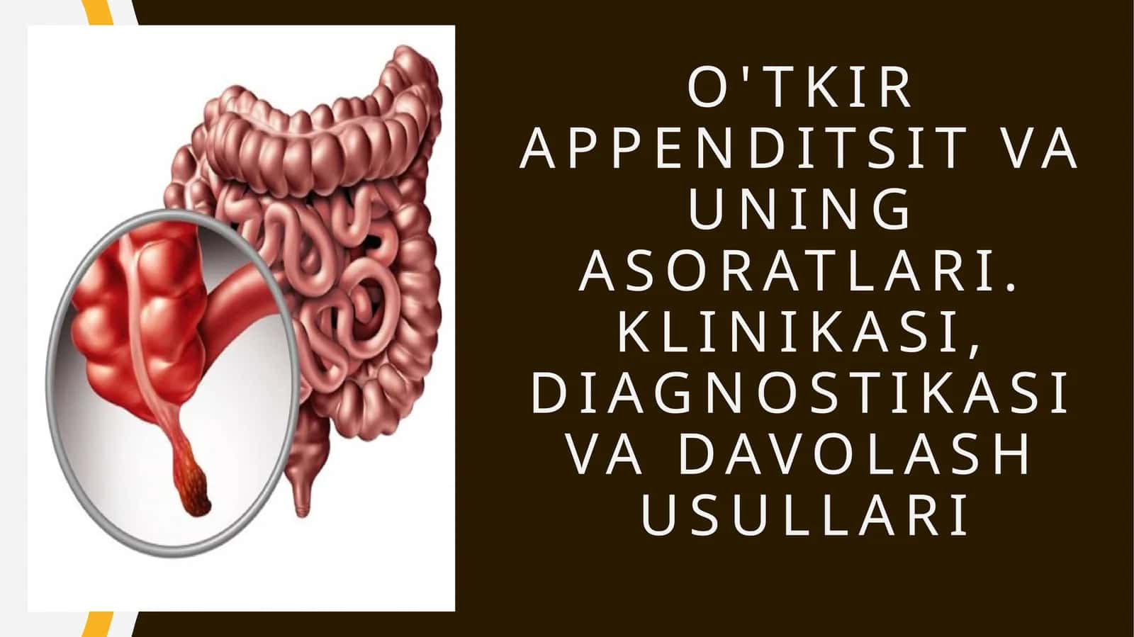 O'tkir appenditsit va uning asoratlari. Klinikasi, diagnostikasi va davolash usullari 1