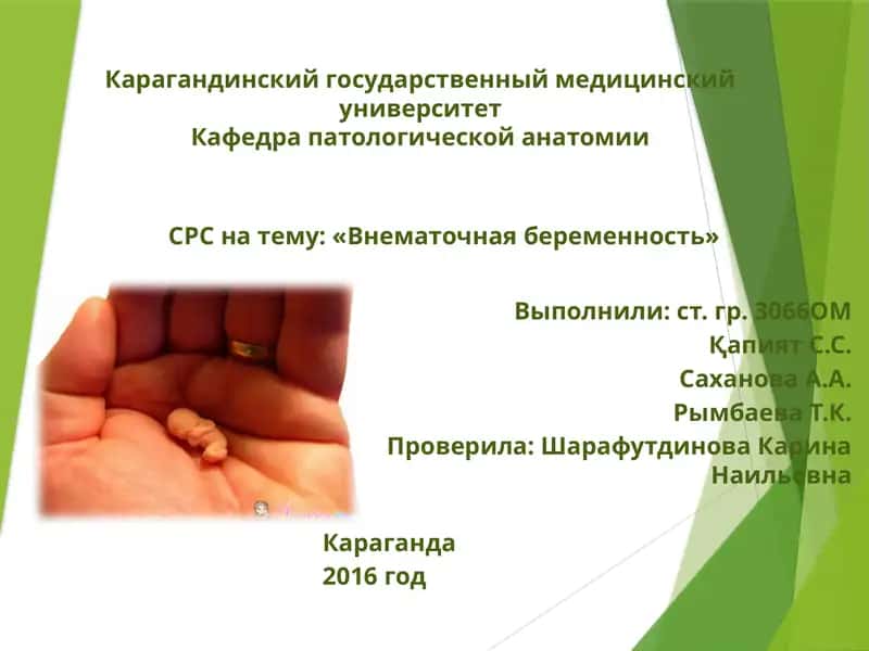 Внематочная беременность 1