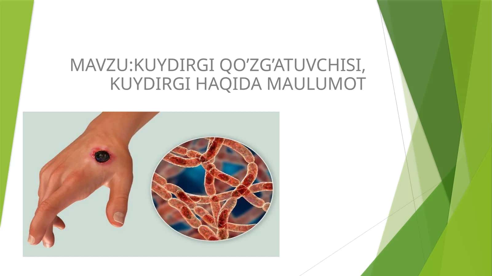 KUYDIRGI QO’ZG’ATUVCHISI, KUYDIRGI HAQIDA MA‘LUMOT 1