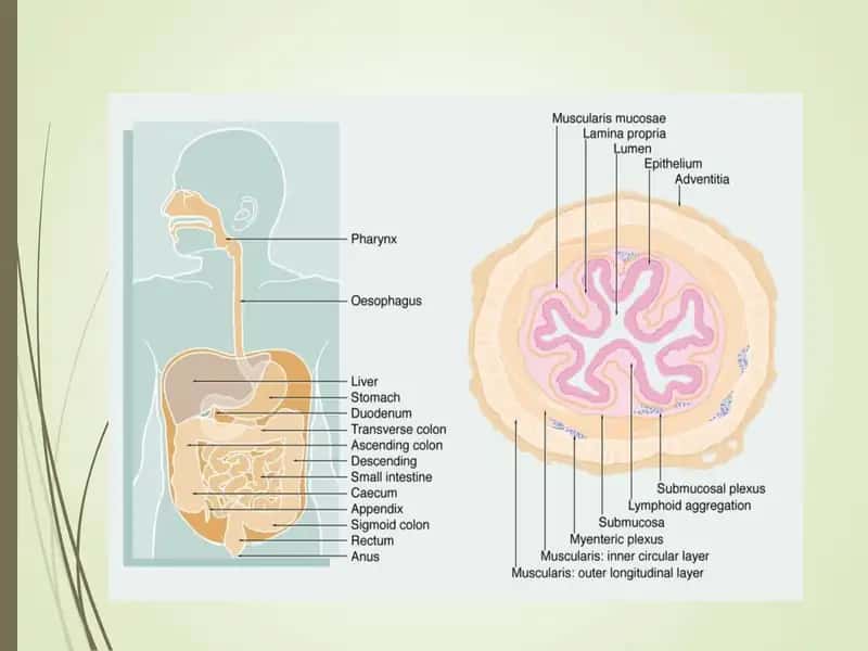 gastrit 1