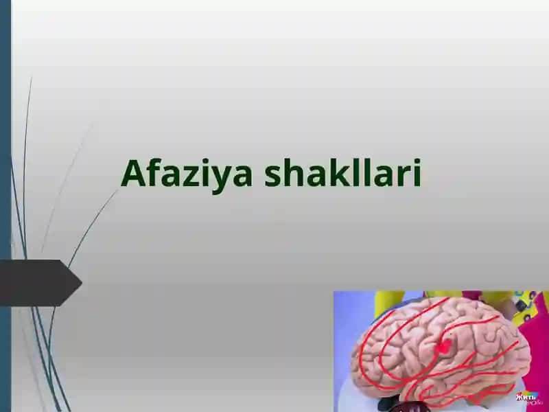 Аfaziya klassifikatsiyalari