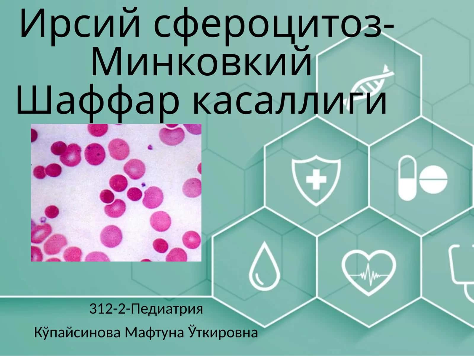 Ирсийсфероцитоз-МинковкийШаффаркасаллиги(gematologiya) 1