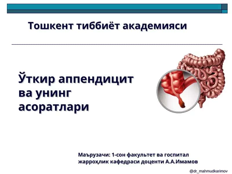Ўткир аппендицит ва унинг асоратлари 1