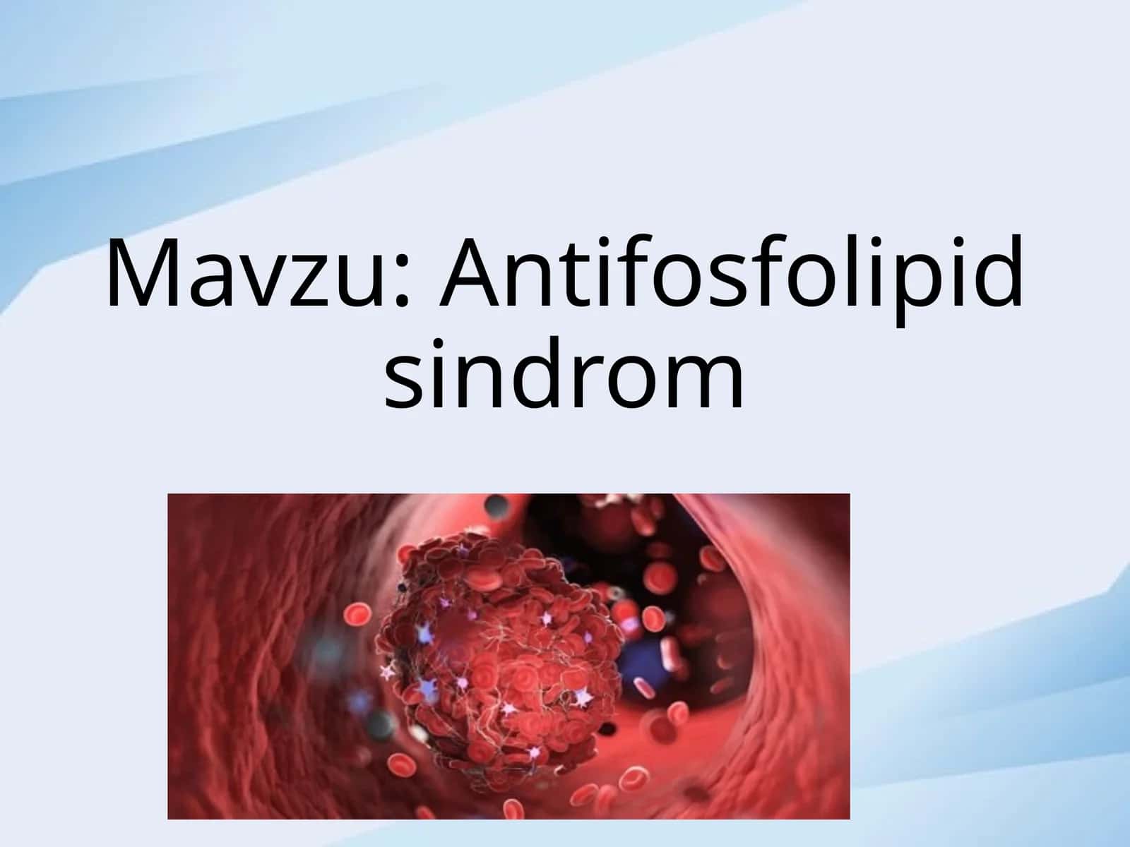 Antifosfolipid sindrom 1