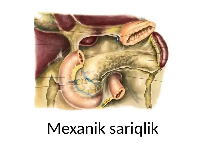 Mexanik  sariqlik 1
