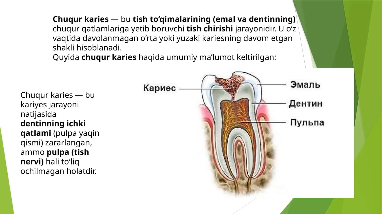 Chuqurkaries 1
