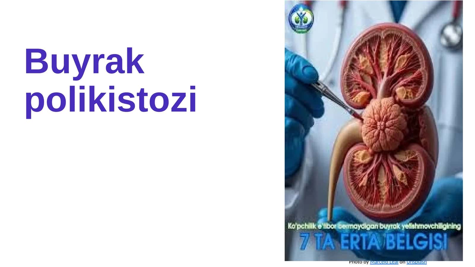 Buyrak polikistozi 1
