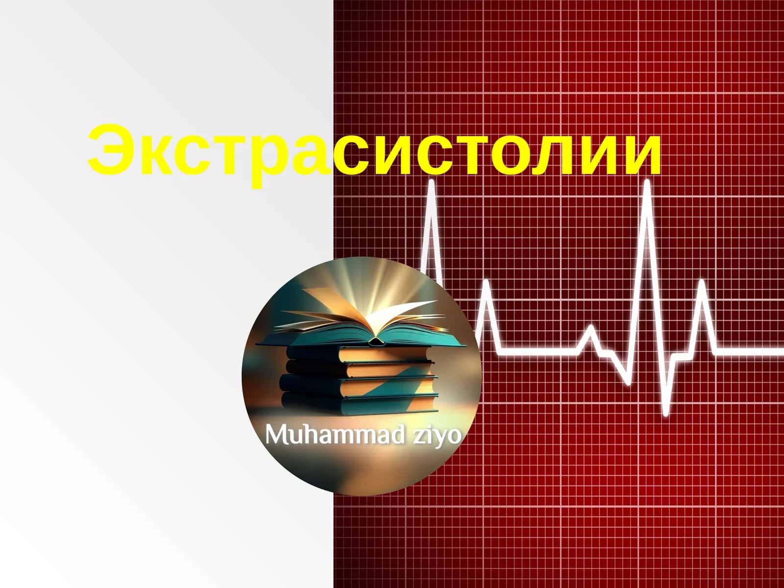 Экстрасистолии 1