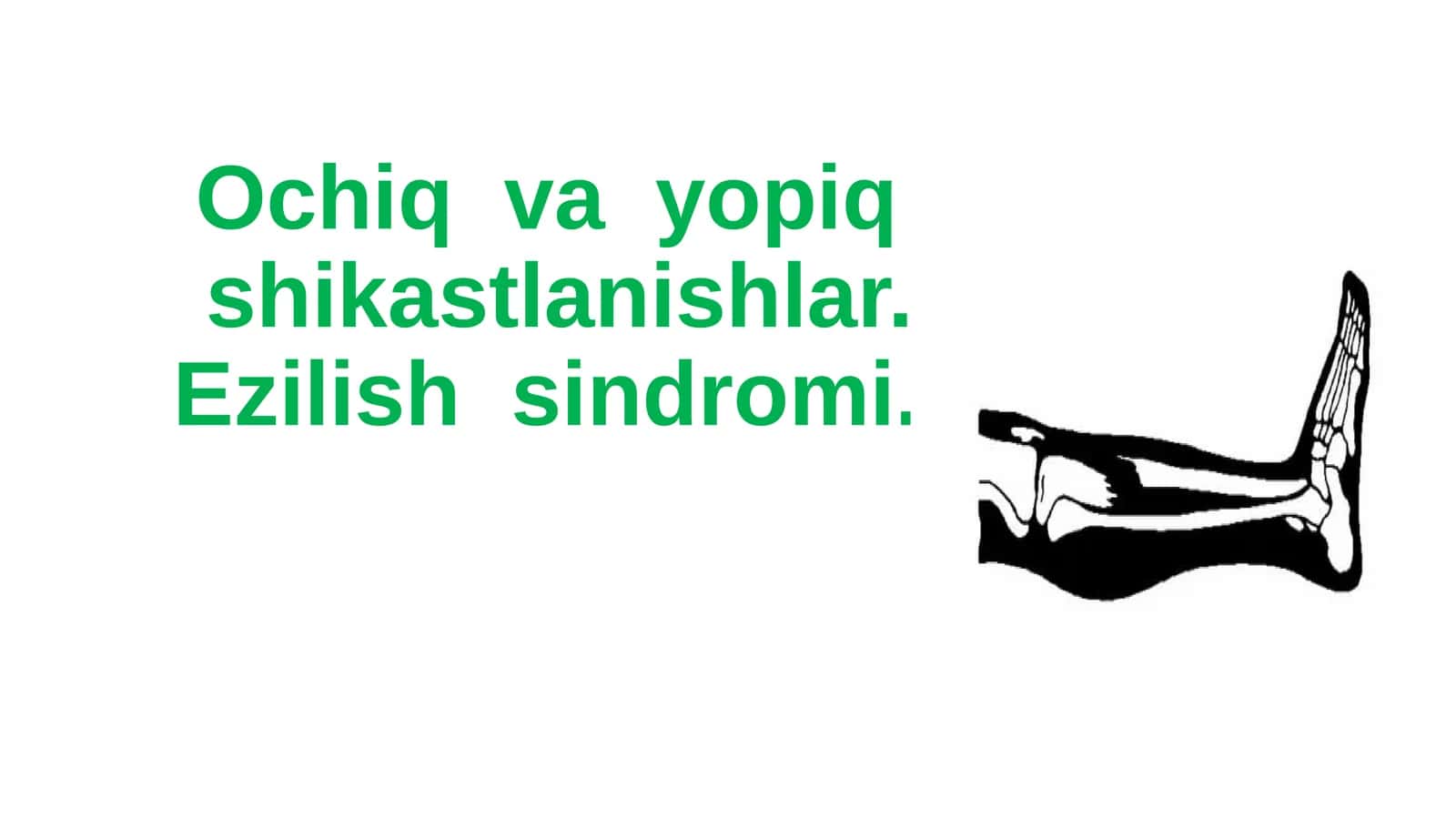Ochiq va yopiq shikastlanishlar, Ezilish sindromi 1