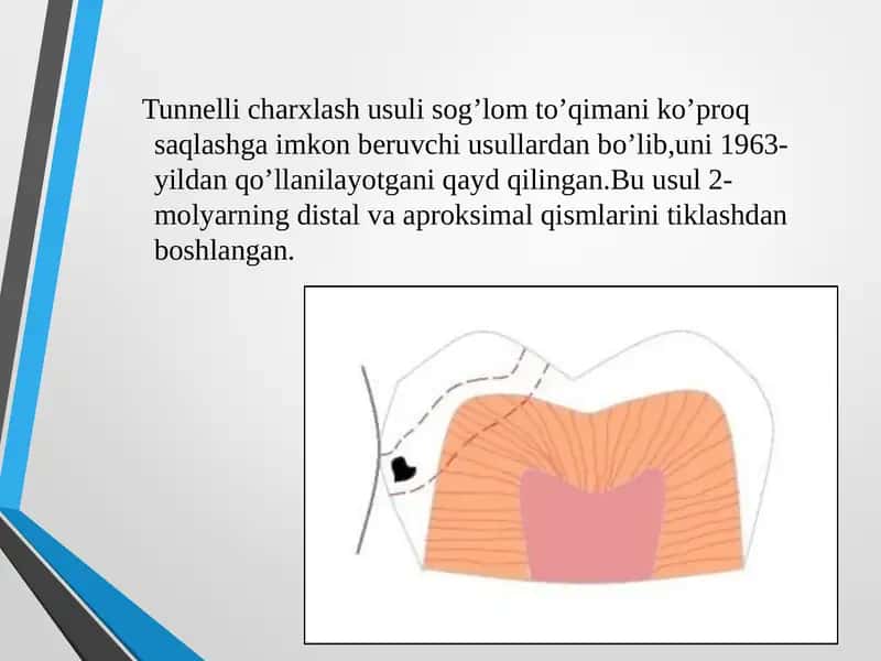 Tunnellicharxlash usuli 1