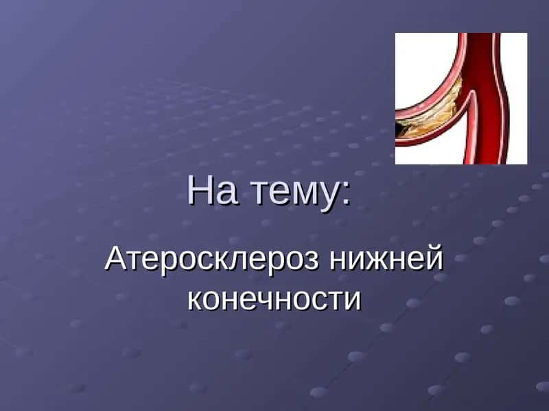 Атеросклероз нижней конечности 1