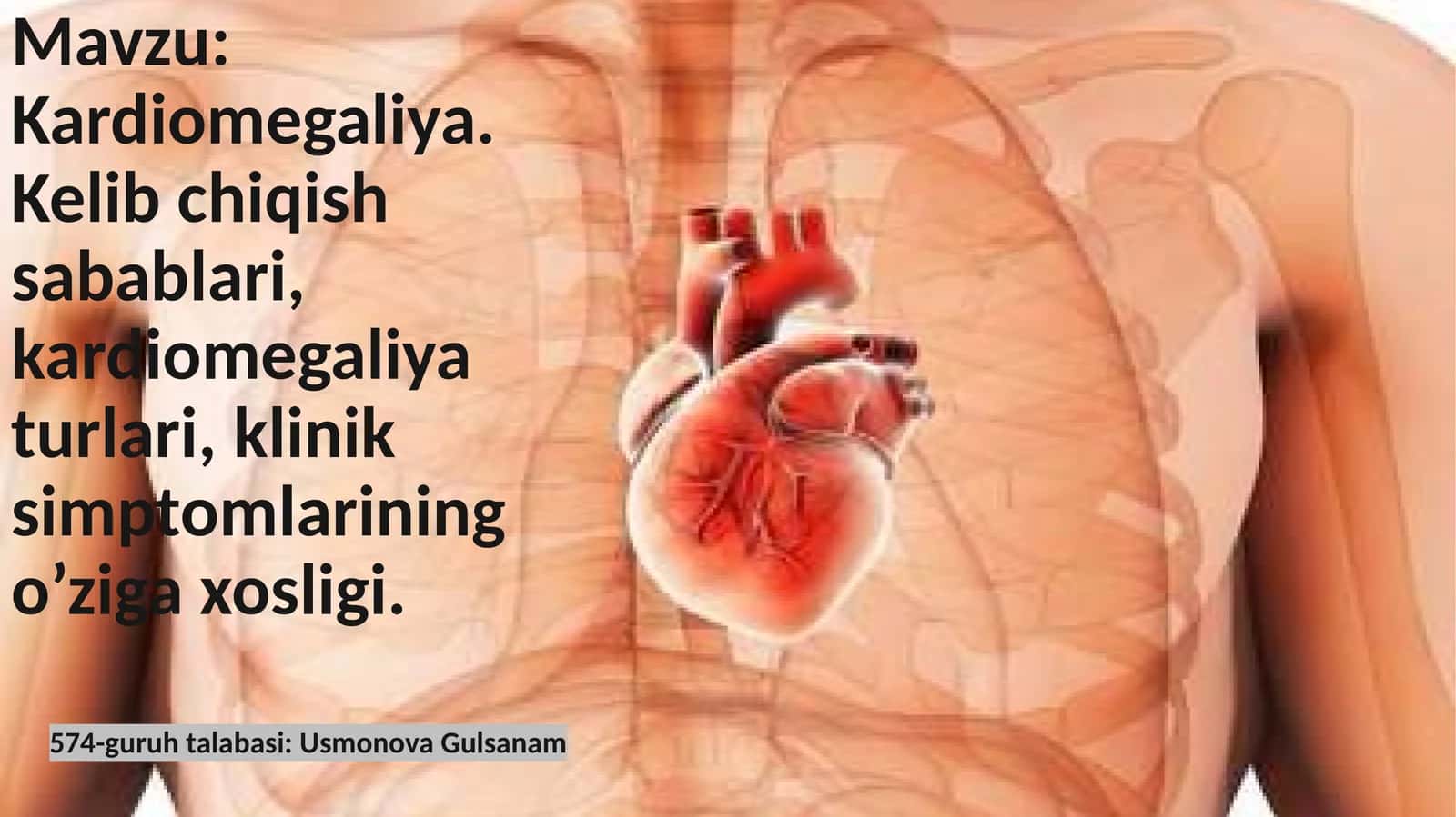 Kardiomegaliya 1