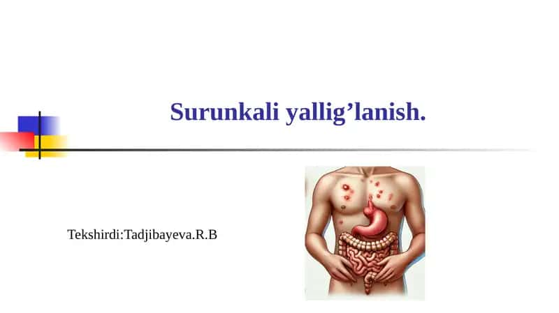 Surunkaliyallig’lanish 1