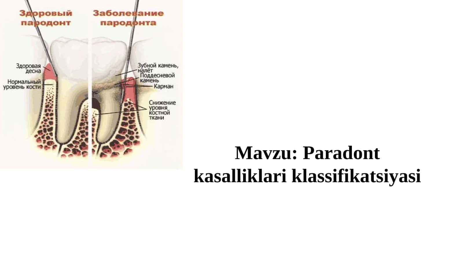 Paradont kasalliklari klassifikatsiyasi 1
