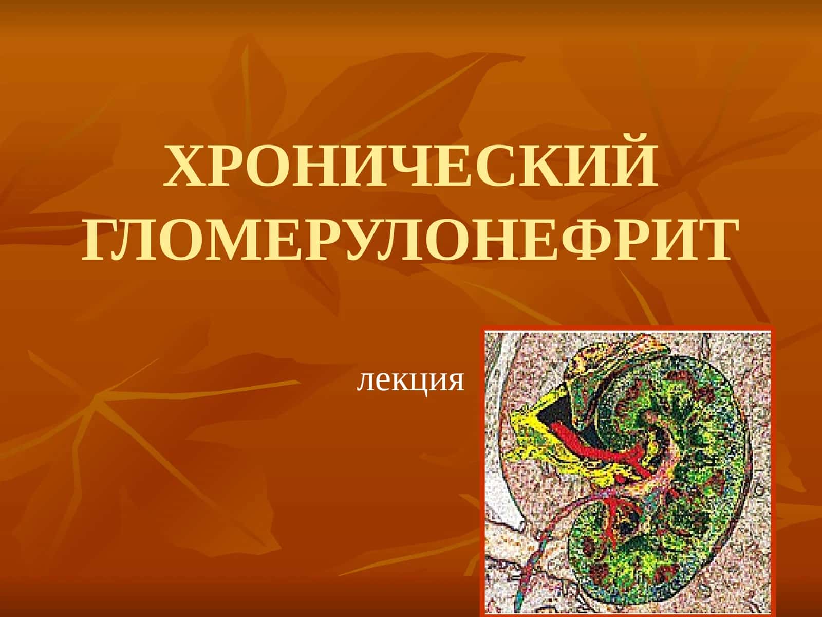 ХРОНИЧЕСКИЙ ГЛОМЕРУЛОНЕФРИТ 1