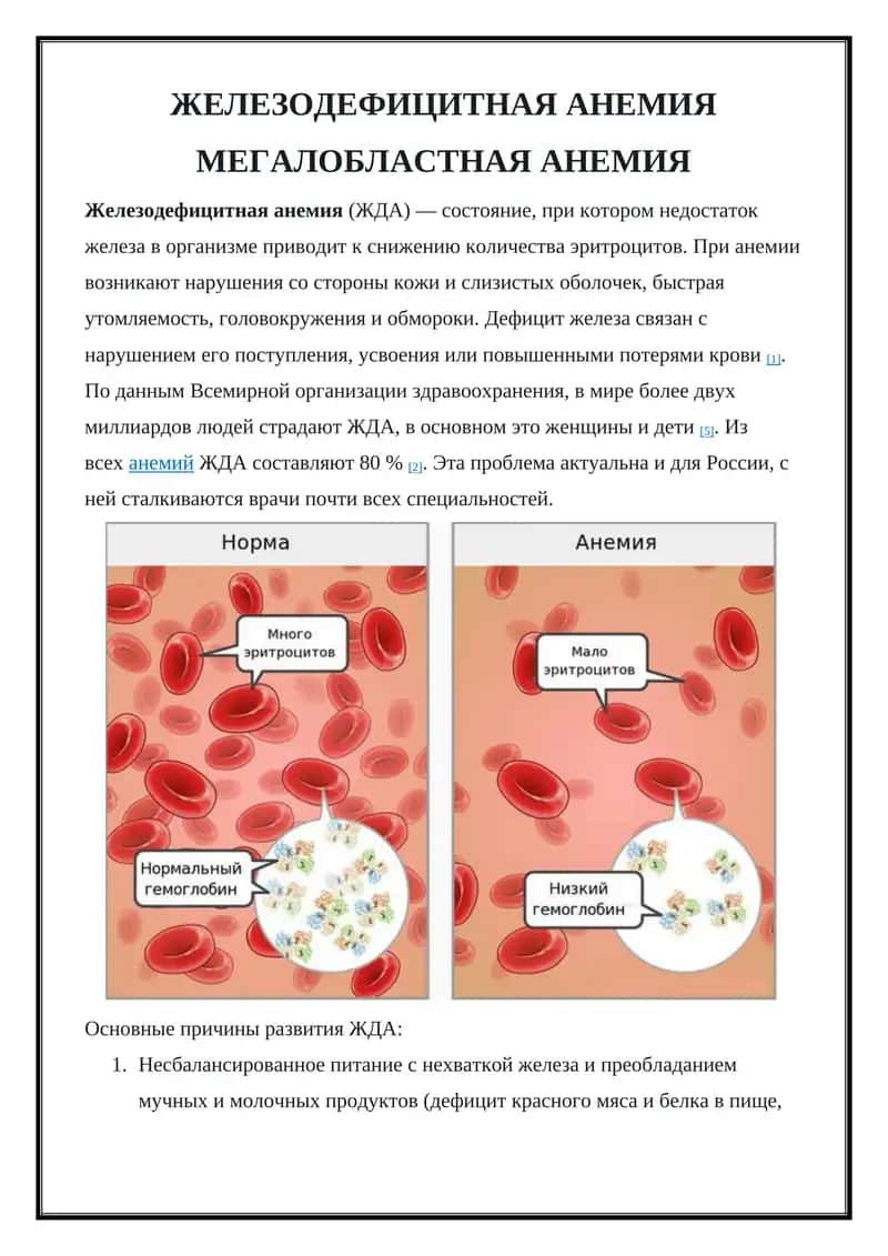Железодефицитная анемия 1