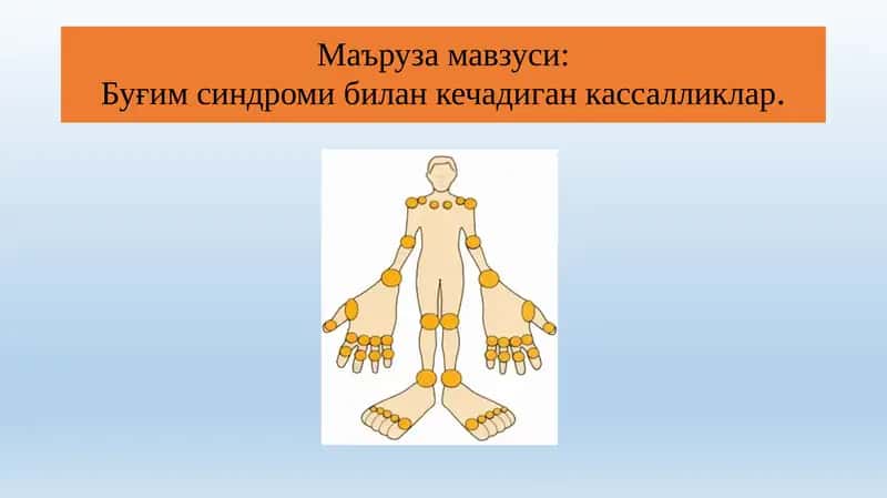 Буғим синдроми билан кечадиган кассалликлар 1