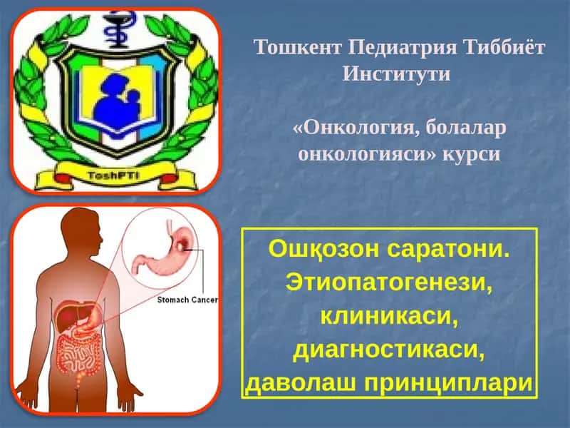 Ошқозонсаратони.Этиопатогенези,клиникаси,диагностикаси,даволашпринциплари 1