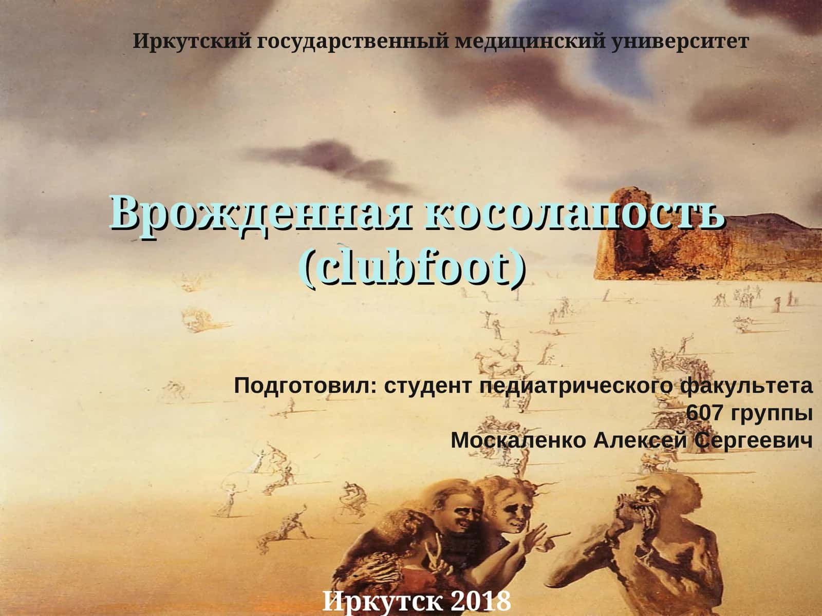 Врожденная косолапость (clubfoot) 1