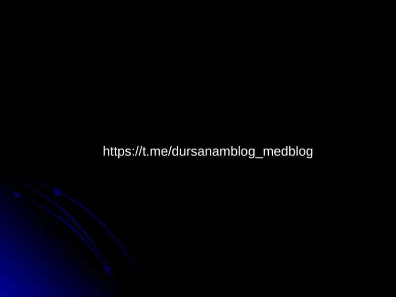 НУР ТАШХИСИ УСУЛЛАРИ 1