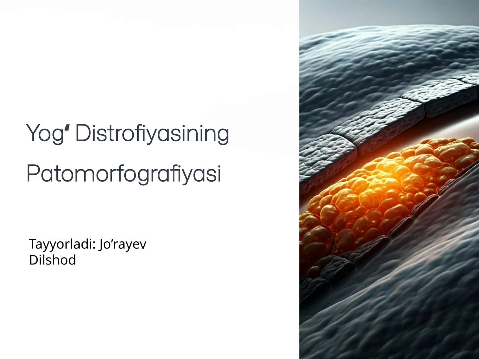 Yogʻ Distrofiyasining Patomorfografiyasi 1