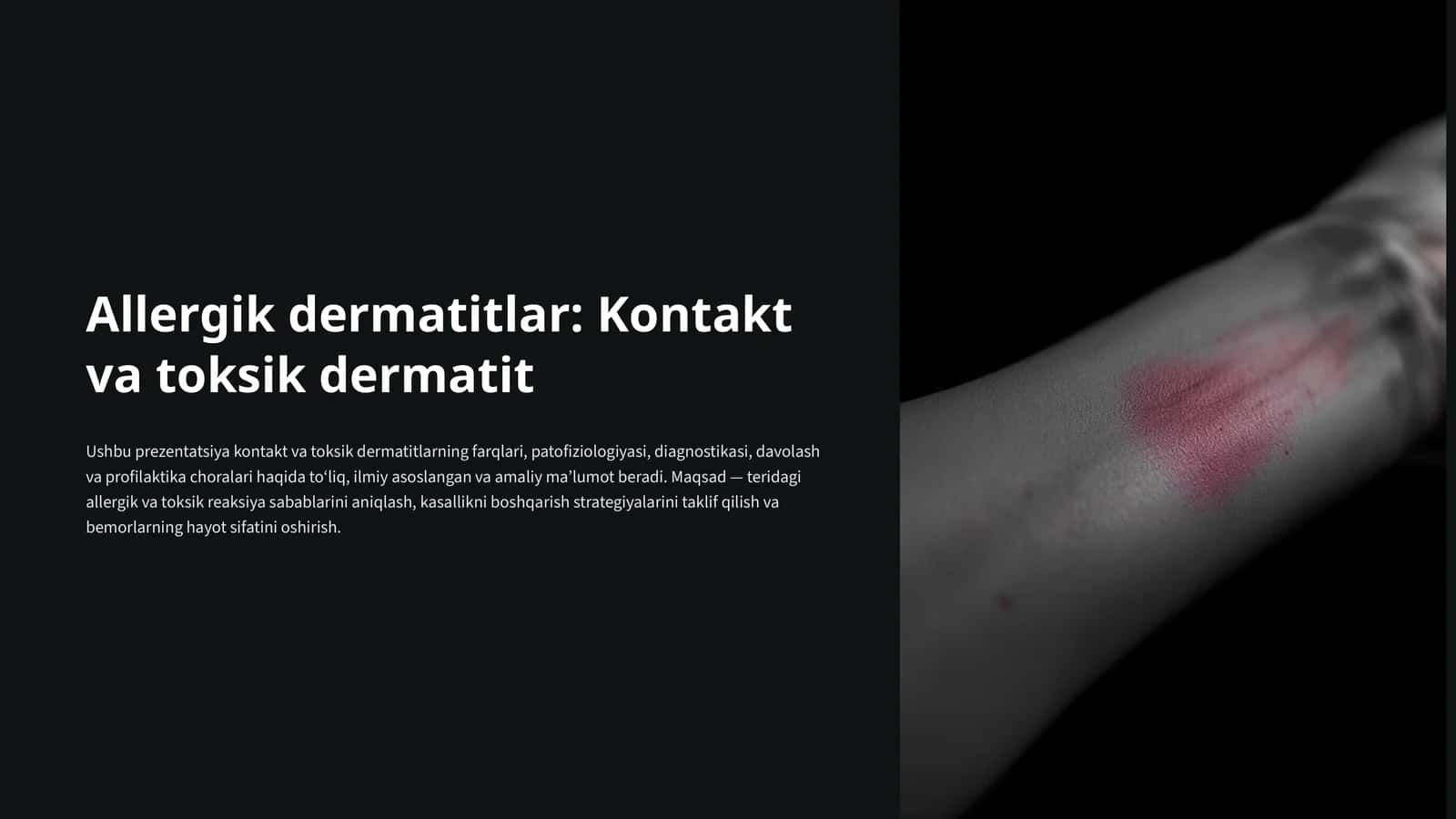 Allergik dermatitlar: Kontakt va toksik dermatit 1