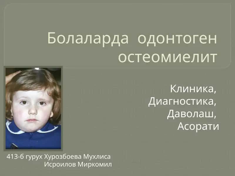 Болаларда одонтоген остеомиелит 1