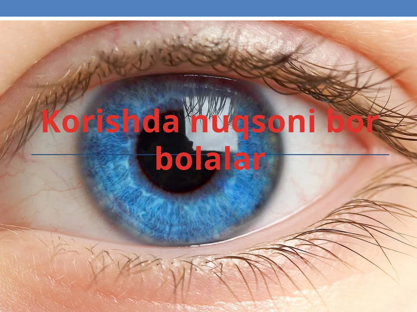 Korishda nuqsoni bor bolalar 1