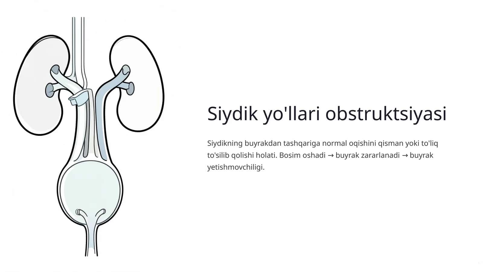 Siydik yo'llari obstruktsiyasi 1